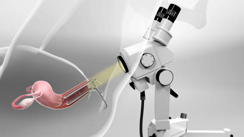 Colposcopy Services Colposcopy Services